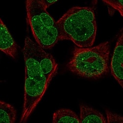 KLHDC2 Antibody, Novus Biologicals:Antibodies:Primary Antibodies